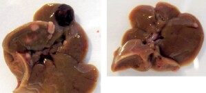 In männlichen Mäusen entwickeln sich durch Erhöhung des Adiponektin-Spiegels kleinere Lebertumore (rechts) als in normalen Tieren (links).