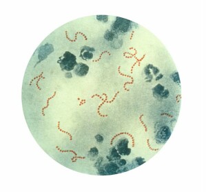 Ketten von Streptococcus pyogenes (A-Streptokokken) im gefärbten Präparat bei 900facher Vergrößerung