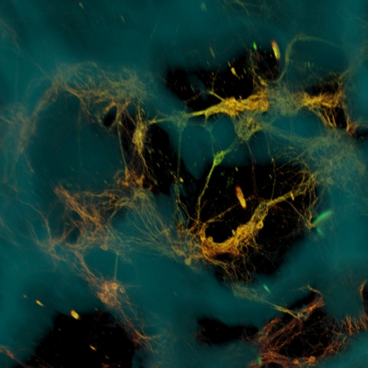 Wie ein Blick ins Gehirn wirkt diese Aufnahme mit einem Konfokalmikroskop. Es zeigt Rattenneuronen in einem künstlich erzeugten Hirngewebe. Die Zellen (grünlich gelb) haften an einem schwammartigen Gerüst aus Seidenprotein (blau) und bilden Fortsätze (Axone), die eine komplex vernetzte Gewebestruktur erzeugen. (siehe: Tissue Engineering - Hirngewebe in 3-D (http://www.wissenschaft-aktuell.de/artikel/Tissue_Engineering__Hirngewebe_in_3_D1771015589621.html)
