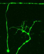 Links (dlk-1-Gen aktiv): Die untere Nervenzelle bildet neue Fortsätze nach oben; Rechts (dlk-1-Gen inaktiv): Kein Wachstum