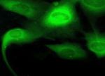 Fibroblasten von Fanconi-Anämie-Patienten nach genetischer Korrektur (grün)