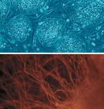Aus menschlichen embryonalen Stammzellen (A) lassen sich Nervenzellen (B) anzüchten.
