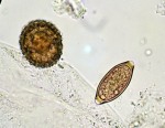 Wurminfektionen lassen sich durch die Eier der Parasiten im Stuhl nachweisen (links: Spulwurm, rechts: Peitschenwurm).