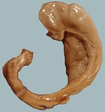 Der Hippocampus hat die Form eines Seepferdchens.