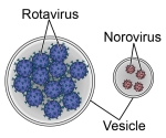 Rotaviren und Noroviren sind die häufigsten Erreger von Magen-Darm-Infektionen bei Kleinkindern.