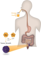 Mit Glukose und Fruktose gesüßte Getränke könnten auch beim Menschen das Wachstum von Darmtumoren beschleunigen.