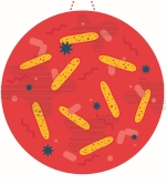 Das intakte Immunsystem (links) sorgt für eine hohe Zahl an Clostridien (gelbe Stäbchen) im Darm und verhindert damit Fettleibigkeit.