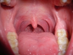 In der Schleimhaut der Mundhöhle leben etwa 700 Arten von Bakterien.