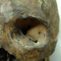 Sichtbare braune Härchen und diverse Weichteilreste am Schädel der etwa 1700 Jahre alten Frauenleiche