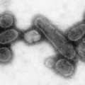 Rekonstruiertes Virus der Spanischen Grippe