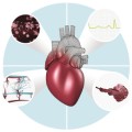 Möglichst viele Patientendaten sollen Computermodelle für schonende Herz-OPs ermöglichen