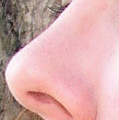 Allergischer Schnupfen äußert sich etwa in juckender, verstopfter oder laufender Nase 