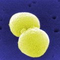 Pneumokokken (Streptococcus pneumoniae) im Rasterelektronenmikroskop