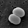 Ein typischer Hautkeim: Staphylococcus epidermidis (im Rasterelektronenmikroskop)