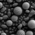 Pollen verschiedener Pflanzen im Elektronenmikroskop
