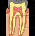 Schematische Darstellung eines Zahns