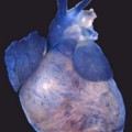 Herz einer adulten Maus mit blau markierten Mikro-RNAs miR-143 und miR-145