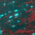 Neue Axone (rot) erreichen ihre Zielzellen (blau) im Gehirn