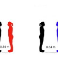 Patientin SM (rot) hatte jedes Gefühl für Distanzzonen verloren und stand am liebsten ganz dicht vor der Versuchsleiterin (schwarz). Gesunde Probanden (blau) hielten dagegen einen Abstand von über 60 zentimetern ein.