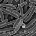 Rasterelektronenmikroskopische Aufnahme von Escherichia coli