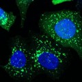 Spermidin aktiviert durch verstärkte Autophagie (grüne Punkte) den Abbau von Zellmüll auch in menschlichen Zellen