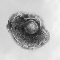 Varicella-Zoster-Virus