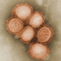 Schweingrippeviren (Influenza A H1N1), kolorierte elektronenmikroskopische Aufnahme