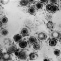 Herpes-simplex-Viren