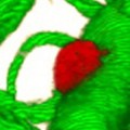 Eine einzelne Lungenkrebszelle (rot) hat das Blutgefäß (grün) im Gehirn verlassen, bleibt aber weiterhin in engem Kontakt damit.
