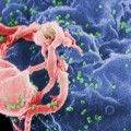 Rasterelektronenmikroskopische Aufnahme von HIV-1-Viren (grün), die aus einem Lymphozyten frei werden
