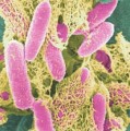 E. coli (gefärbtes Präparat)