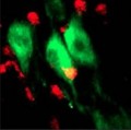 Immunzellen (rot) attackieren Nervenzellen von Mäusen.