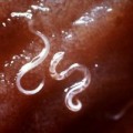 Hakenwürmer (Ancylostoma caninum) im Darm eines Hundes