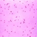 Neisseria gonorrhoeae (Gram-Färbung)
