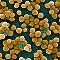 Staphylococcus aureus im Rasterelektronenmikroskop (koloriert)