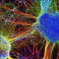 Aus Hautzellen erzeugte Neuronen von schizophrenen Patienten (Zellkerne blau gefärbt)