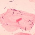 Milchsäurebakterien in der Vagina 