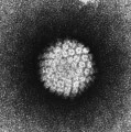 Elektronenmikroskopische Aufnahme eines menschlichen Papillomavirus (HPV)