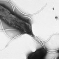 Elektronenmikroskopische Aufnahme von Helicobacter pylori