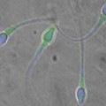 Eine Farbmarkierung (grüne Punkte) macht Unterschiede in der Zusammensetzung der Spermienhüllen sichtbar.