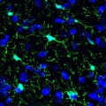 Gehirnzellen der Maus: Mikroglia-Zellen sind grün, Zellkerne blau gefärbt.
