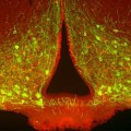 Das Gefühl von Sättigung erzeugende Neuronen (grün) im Hypothalamus, von denen einige (mit rotem Kern) aktiviert wurden
