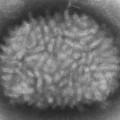 Vaccinia-Virus im Elektronenmikroskop