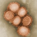Schweinegrippeviren im Elektronenmikroskop (koloriert)