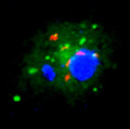 Mycobacterium tuberculosis (rot) in einem menschlichen Makrophagen (blau und grün)