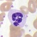Neutrophile Granulozyten sind weiße Blutkörperchen, die als Teil der angeborenen Immunabwehr Mikroben zerstören – auch indem sie Defensine freisetzen.