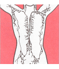 Das Lymphsystem besteht aus Lymphbahnen und Lymphknoten.