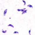 Teilungsfähige Formen (sogenannte Tachyzoiten) von Toxoplasma gondii (Giemsa-Färbung)