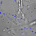 Mikroskopische Aufnahme des Myzel bildenden Boden-Mikroorganimus Pythium ultimum welcher Phenanthren in seinem Zellinnern transportiert: Overlay eines Durchlicht- und Fluoreszenzbildes von Pythium ultimum, dessen Hyphen Phenanthren-angereicherte Vesikel (in blau) enthalten (Balkenlänge: 5 Mikrometer)