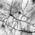 Neuronen des zentralen Nervensystems werden bei Multipler Sklerose durch Immunreaktionen geschädigt.